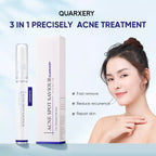 Acne Spot Saviour