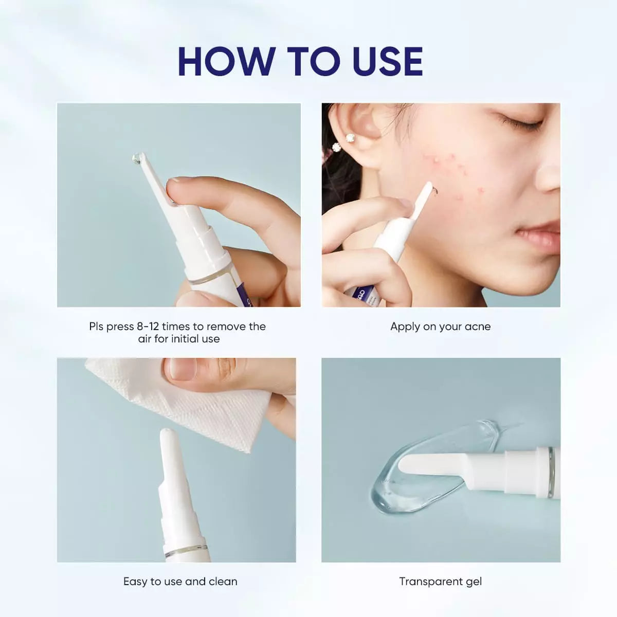 Acne Spot Saviour