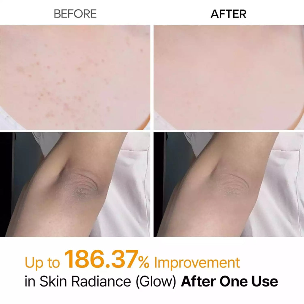Body Exfoliator Spray